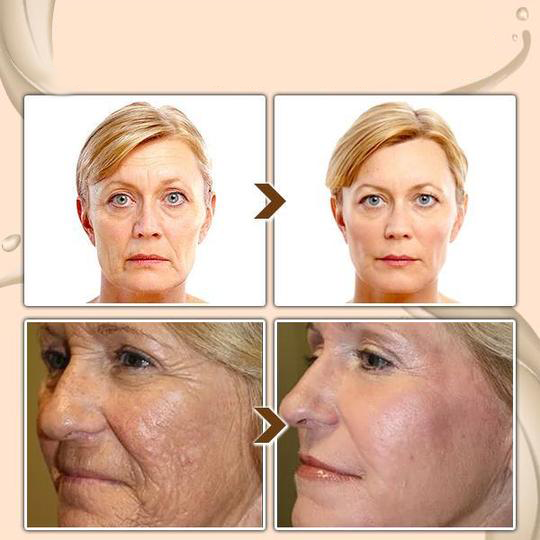 BBOJI™ Turmeric Milk Face Serum - Antioxidant Serum with Sodium Hyaluronate, Niacinamide, and Milk Extract - Anti-Aging & Skin Brightening with Curcuma Longa - 30 ml