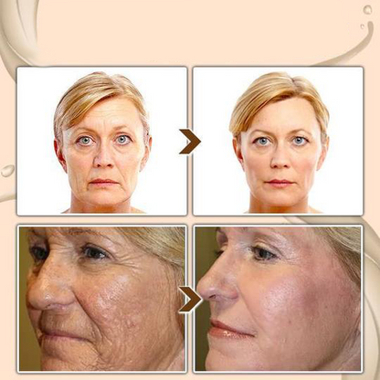 BBOJI™ Turmeric Milk Face Serum - Antioxidant Serum with Sodium Hyaluronate, Niacinamide, and Milk Extract - Anti-Aging & Skin Brightening with Curcuma Longa - 30 ml