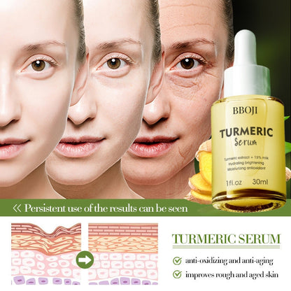 BBOJI™ Turmeric Milk Face Serum - Antioxidant Serum with Sodium Hyaluronate, Niacinamide, and Milk Extract - Anti-Aging & Skin Brightening with Curcuma Longa - 30 ml
